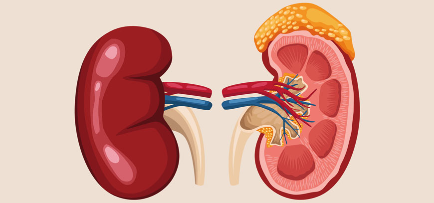 kidney-cancer-treatment